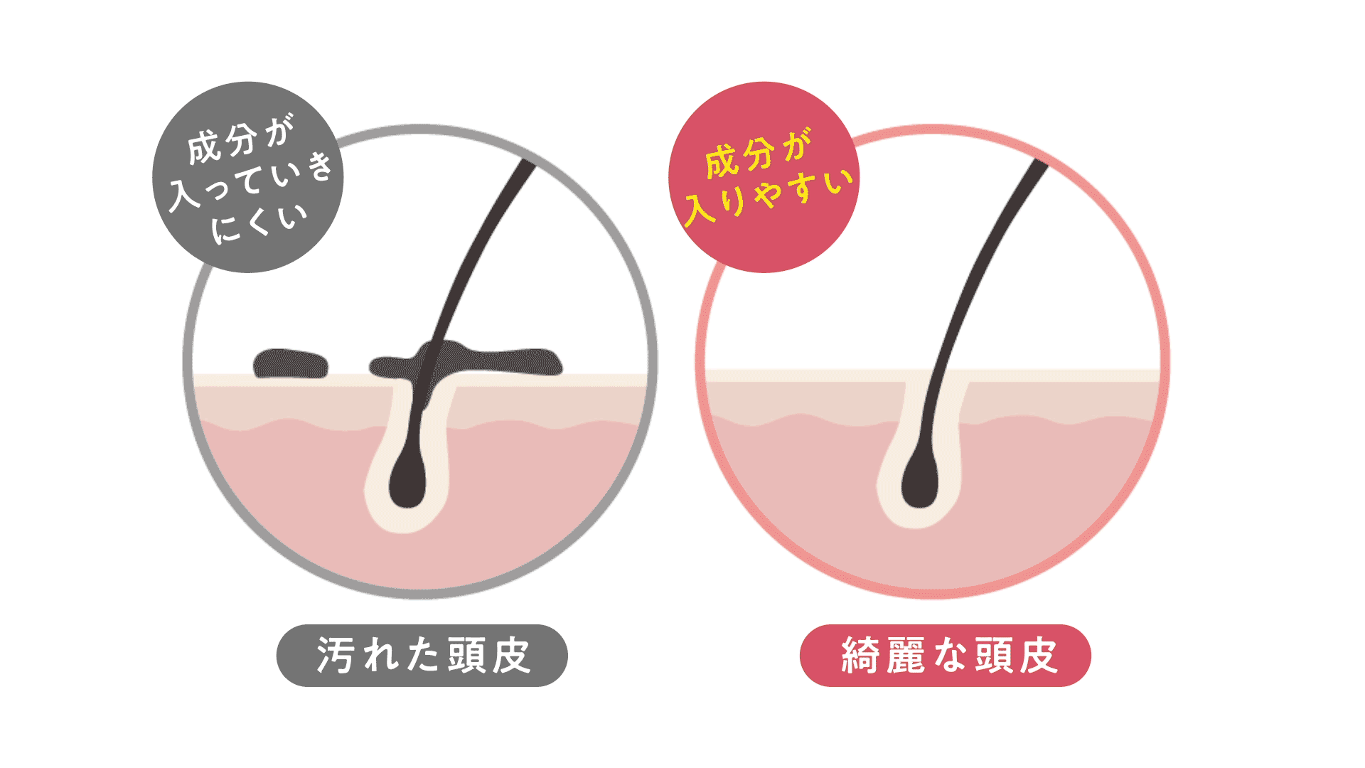 ヘッドスパ